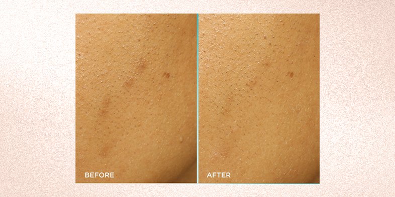 In Article The Best Skin Care Routine For Aging Skin Dark Spot Serum